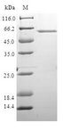 XRCC4 Protein - (Tris-Glycine gel) Discontinuous SDS-PAGE (reduced) with 5% enrichment gel and 15% separation gel.