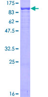 XRCC5 / Ku80 Protein - 12.5% SDS-PAGE of human XRCC5 stained with Coomassie Blue