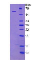 XRCC5 / Ku80 Protein - Recombinant X-Ray Repair Cross Complementing 5 By SDS-PAGE