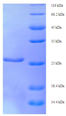 XRCC5 / Ku80 Protein