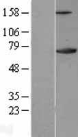 XRCC6 / Ku70 Protein - Western validation with an anti-DDK antibody * L: Control HEK293 lysate R: Over-expression lysate