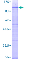 XRCC6 / Ku70 Protein - 12.5% SDS-PAGE of human XRCC6 stained with Coomassie Blue