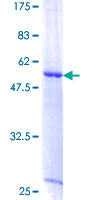XRCC6BP1 Protein - 12.5% SDS-PAGE of human XRCC6BP1 stained with Coomassie Blue