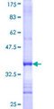 XRCC6BP1 Protein - 12.5% SDS-PAGE Stained with Coomassie Blue.