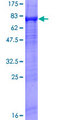 XRN1 Protein - 12.5% SDS-PAGE of human XRN1 stained with Coomassie Blue