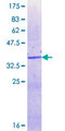 XRN2 Protein - 12.5% SDS-PAGE Stained with Coomassie Blue.