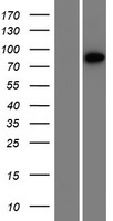 XRRA1 Protein - Western validation with an anti-DDK antibody * L: Control HEK293 lysate R: Over-expression lysate