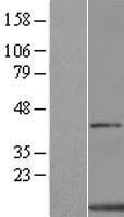 XTP4 / C17orf37 Protein - Western validation with an anti-DDK antibody * L: Control HEK293 lysate R: Over-expression lysate