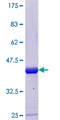 XTP4 / C17orf37 Protein - 12.5% SDS-PAGE of human C17orf37 stained with Coomassie Blue