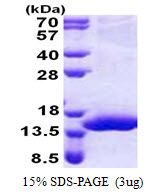 XTP4 / C17orf37 Protein