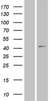 XXYLT1 Protein - Western validation with an anti-DDK antibody * L: Control HEK293 lysate R: Over-expression lysate