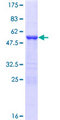 YAF2 Protein - 12.5% SDS-PAGE of human YAF2 stained with Coomassie Blue