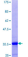 YAF2 Protein - 12.5% SDS-PAGE Stained with Coomassie Blue.