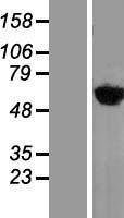 YARS / Tyrosyl-tRNA Synthetase Protein - Western validation with an anti-DDK antibody * L: Control HEK293 lysate R: Over-expression lysate