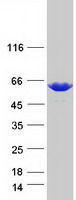 YARS / Tyrosyl-tRNA Synthetase Protein - Purified recombinant protein YARS was analyzed by SDS-PAGE gel and Coomassie Blue Staining