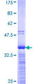 YBX1 / YB1 Protein - 12.5% SDS-PAGE Stained with Coomassie Blue.
