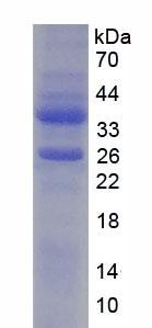 YBX1 / YB1 Protein - Recombinant Y-Box Binding Protein 1 (YBX1) by SDS-PAGE