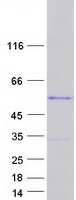 YBX1 / YB1 Protein - Purified recombinant protein YBX1 was analyzed by SDS-PAGE gel and Coomassie Blue Staining