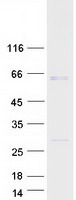 YBX3 / CSDA Protein - Purified recombinant protein YBX3 was analyzed by SDS-PAGE gel and Coomassie Blue Staining