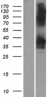 YDJC Protein - Western validation with an anti-DDK antibody * L: Control HEK293 lysate R: Over-expression lysate