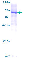 YES1 / c-Yes Protein - 12.5% SDS-PAGE of human YES1 stained with Coomassie Blue