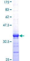 YES1 / c-Yes Protein - 12.5% SDS-PAGE Stained with Coomassie Blue.