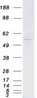 YES1 / c-Yes Protein - Purified recombinant protein YES1 was analyzed by SDS-PAGE gel and Coomassie Blue Staining