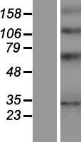YIPF1 Protein - Western validation with an anti-DDK antibody * L: Control HEK293 lysate R: Over-expression lysate