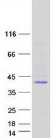 YIPF2 Protein - Purified recombinant protein YIPF2 was analyzed by SDS-PAGE gel and Coomassie Blue Staining