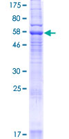 YIPF3 Protein - 12.5% SDS-PAGE of human YIPF3 stained with Coomassie Blue