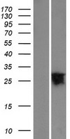 YIPF6 Protein - Western validation with an anti-DDK antibody * L: Control HEK293 lysate R: Over-expression lysate