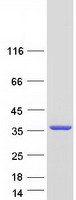 YJEFN3 Protein - Purified recombinant protein YJEFN3 was analyzed by SDS-PAGE gel and Coomassie Blue Staining
