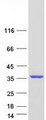 YJEFN3 Protein - Purified recombinant protein YJEFN3 was analyzed by SDS-PAGE gel and Coomassie Blue Staining