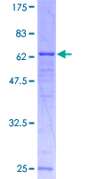 YKL39 / CHI3L2 Protein - 12.5% SDS-PAGE of human CHI3L2 stained with Coomassie Blue