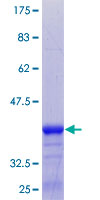 YKT6 Protein - 12.5% SDS-PAGE Stained with Coomassie Blue.