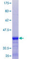 YKT6 Protein - 12.5% SDS-PAGE Stained with Coomassie Blue.