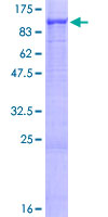 YME1L1 Protein - 12.5% SDS-PAGE of human YME1L1 stained with Coomassie Blue