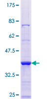 YME1L1 Protein - 12.5% SDS-PAGE Stained with Coomassie Blue.