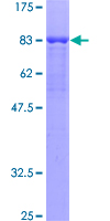 Yo / CDR2 Protein - 12.5% SDS-PAGE of human CDR2 stained with Coomassie Blue