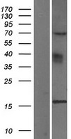 YPEL3 Protein - Western validation with an anti-DDK antibody * L: Control HEK293 lysate R: Over-expression lysate