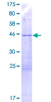 YPEL3 Protein - 12.5% SDS-PAGE of human YPEL3 stained with Coomassie Blue