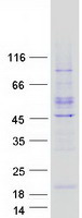 YPEL4 Protein - Purified recombinant protein YPEL4 was analyzed by SDS-PAGE gel and Coomassie Blue Staining