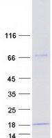 YPEL5 Protein - Purified recombinant protein YPEL5 was analyzed by SDS-PAGE gel and Coomassie Blue Staining
