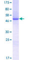 YRDC Protein - 12.5% SDS-PAGE of human YRDC stained with Coomassie Blue
