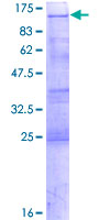 YTHDC1 Protein - 12.5% SDS-PAGE of human YTHDC1 stained with Coomassie Blue