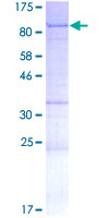 YTHDF1 Protein - 12.5% SDS-PAGE of human YTHDF1 stained with Coomassie Blue