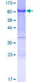 YTHDF3 Protein - 12.5% SDS-PAGE of human YTHDF3 stained with Coomassie Blue