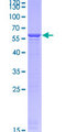 YWHAH / 14-3-3 Eta Protein - 12.5% SDS-PAGE of human YWHAH stained with Coomassie Blue
