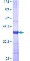 YWHAH / 14-3-3 Eta Protein - 12.5% SDS-PAGE Stained with Coomassie Blue.