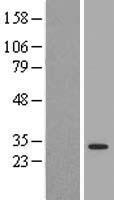 YWHAQ / 14-3-3 Theta Protein - Western validation with an anti-DDK antibody * L: Control HEK293 lysate R: Over-expression lysate